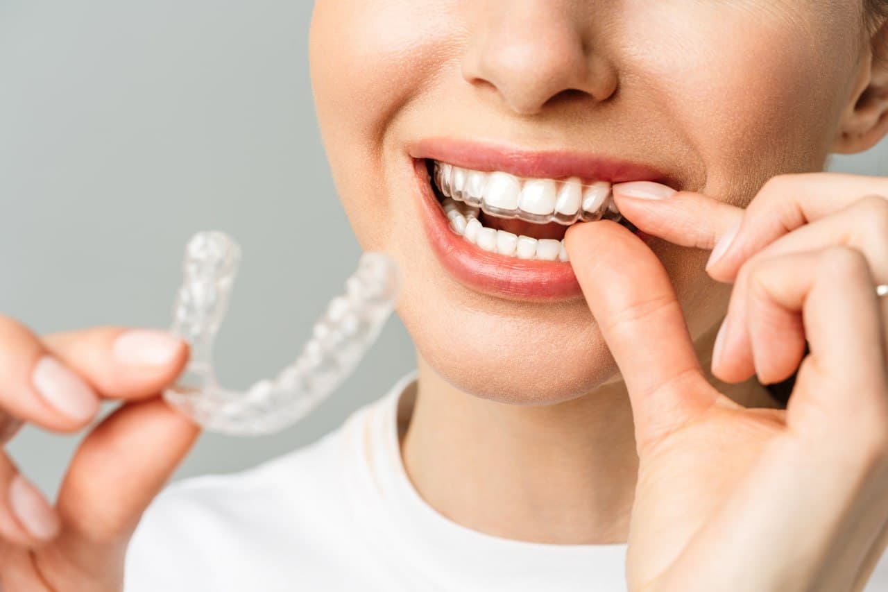 Orthodontics at Roomchang Dental Hospital