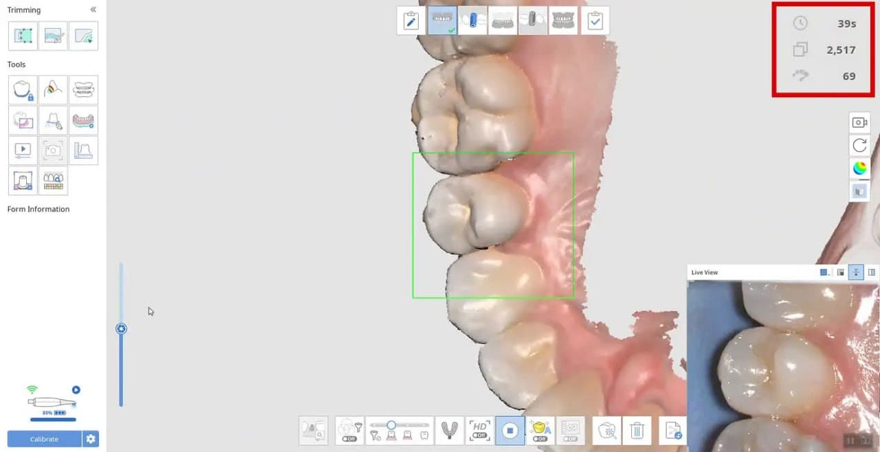 3D digital scan of teeth using CAD software at Roomchang